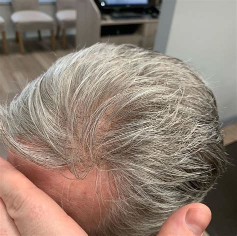 The pins fit comfortably in hair. Do You Want to Apply the Grey Hair Pieces to Enhance ...