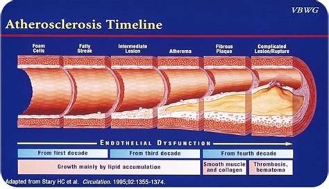 Clinical Uses And Implications Zoll Itamar