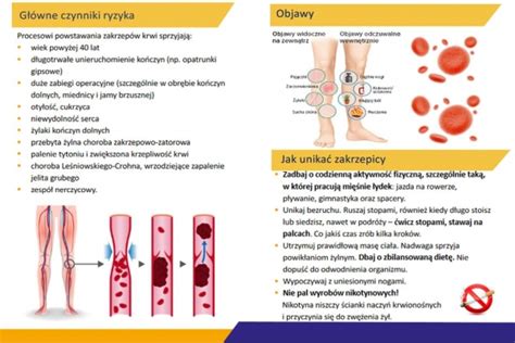 Profilaktyka choroby zakrzepowo zatorowej ŁaskOnline pl Codzienna