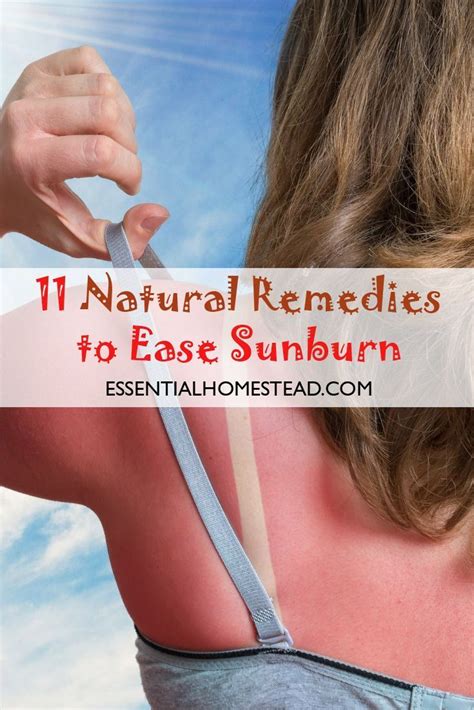 11 Natural Remedies To Ease Sunburn In 2020 Sunburn Remedies Skin Natural Remedies Sunburn
