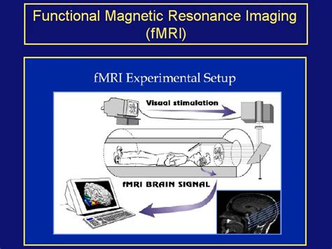 Functional Magnetic Resonance Imaging Fmri