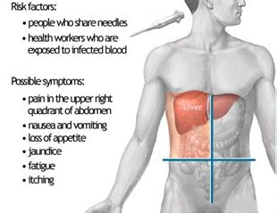 In the united states, chronic alcoholism and hepatitis c are the most common ones. Liver Cirrhosis,Liver Cirrhosis Treatment,India Cirrhosis ...