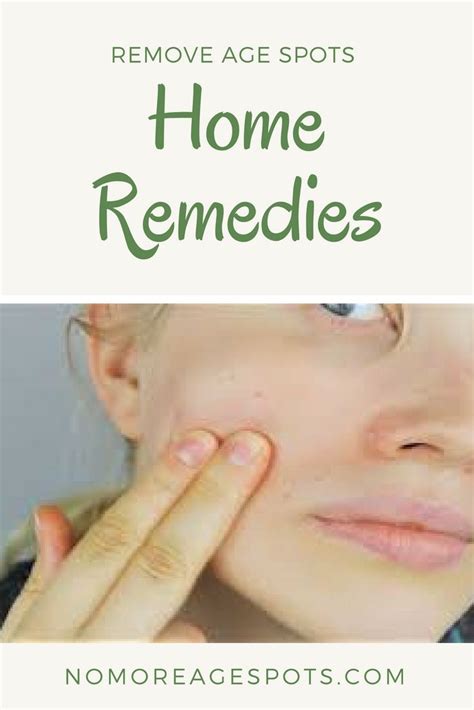 Remove Age Spots With These Home Remedies What Really Works And What