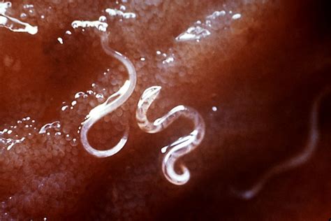 Top 10 Dangerous Parasites That Infect Humans Part 2 Tenzzies