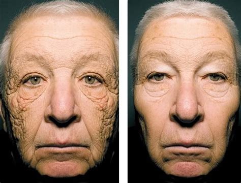 Accept It This Is What Tanning Does To Your Face — Ethereal Aura Spa