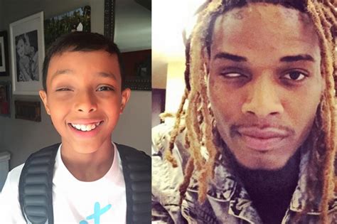 Fetty Wap Inspired A Year Old Boy To Stop Wearing His Prosthetic Eye