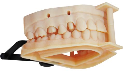 Dentistry innovation future technology titan metal thread. 3D Printed Dental Models - Iverson Dental Labs