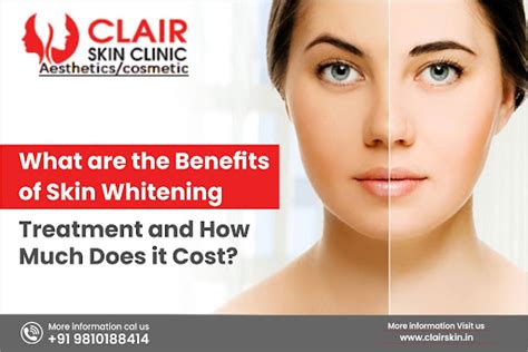 What Are The Benefits Of Skin Whitening Treatment And How Much Does It Cost