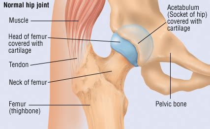 Knee assessment and hip mechanics online course: Traumatic Dislocation of the Hip - Harvard Health
