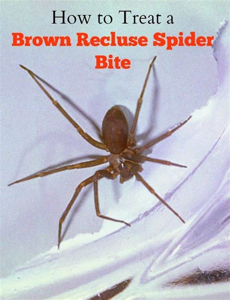 What Does A Brown Recluse Spider Bite Look Like At Th