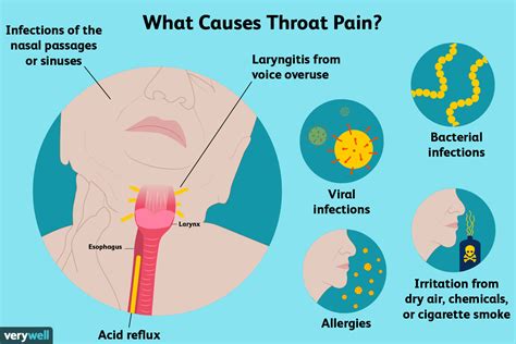 Causes Of Throat Pain And Treatment Options 2022