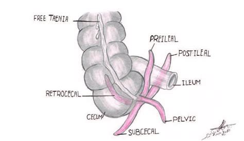 Various Anatomical Positions Of The Appendix Download Scientific Diagram