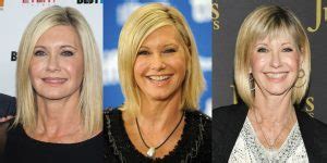 Olivia Newton John Plastic Surgery Before And After Pictures 2024