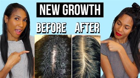 Manage New Growth While Stretching Your Relaxer Soften New Growth Youtube