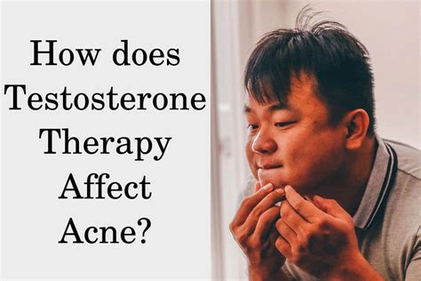 Is Testosterone A Cause Of Your Acne HRTGuru