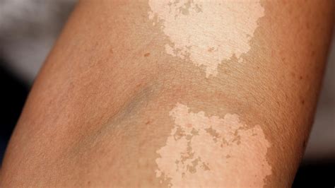 12 Skin Conditions You Should Know About