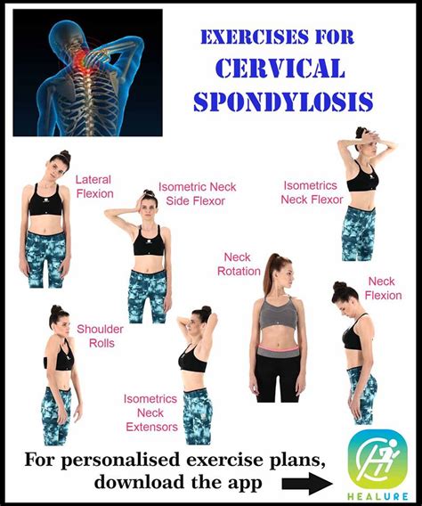 Neck Strengthening Exercises For Cervical Spondylosis Exercise Poster 8625 Hot Sex Picture