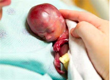 Gift ideas for parents of stillborn baby. New Invention Gives Parents More Time to Grieve the Death ...