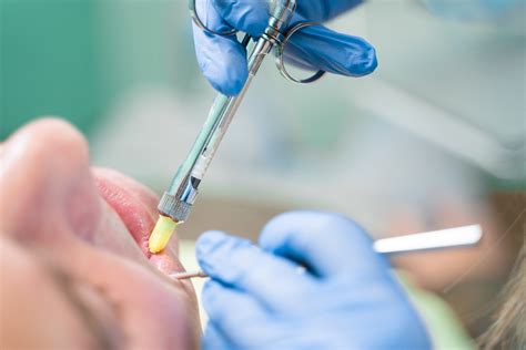 Anestésicos Odontológicos Tudo O Que O Dentista Precisa Saber