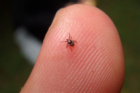 Kentucky Toddler Contracts Rare Disease From Tick Bite