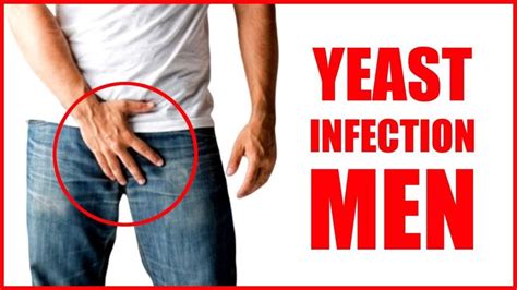 Yeast Infection In Men Male Yeast Infection Symptoms Thrush Fungal Infection In Private Parts