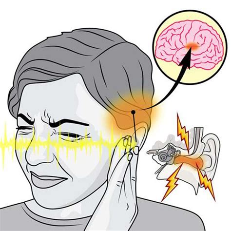 Why Do My Ears Make Noise Worcester Ma Tinnitus Evaluation