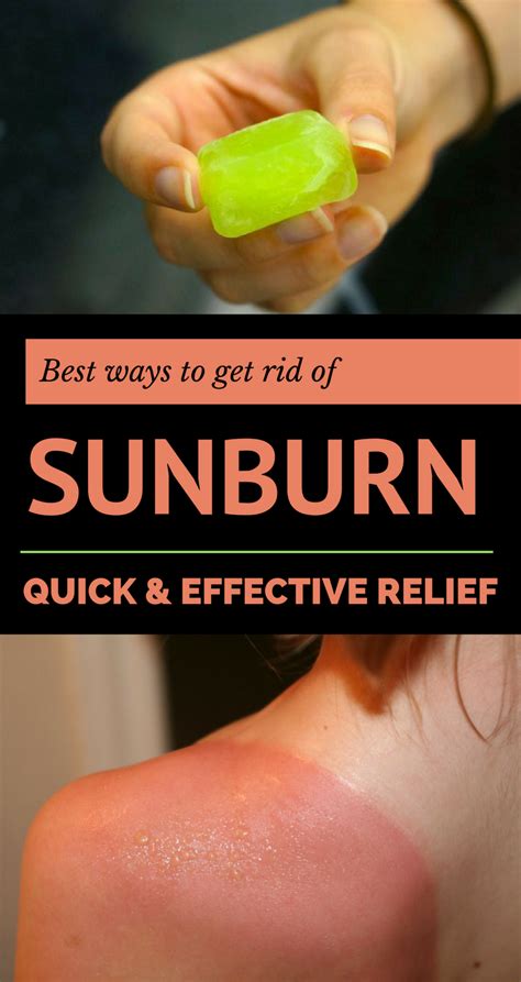 Best Ways To Get Rid Of Sunburn Quick And Effective Relief In