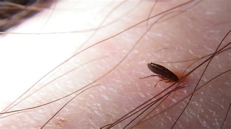 Can Fleas Survive And Reproduce On Human Blood
