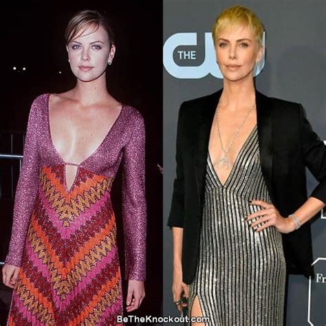 Charlize Theron Plastic Surgery Comparison Photos