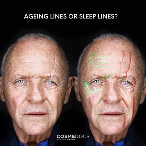 ⭐️ We Love This Graphic From Cosmedocs Can You Tell The Difference