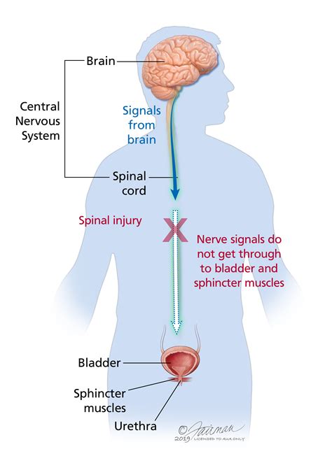Neurogenic Bladder Symptoms Diagnosis And Treatment Urology Care Foundation