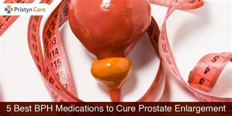 5 Best Bph Medications For Enlarged Prostate Treatment Pristyn Care