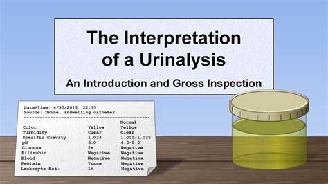 Interpretation Of The Urinalysis Part Introduction And Inspection YouTube