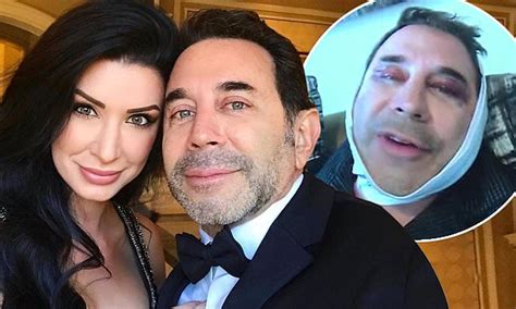 Botched Star Dr Paul Nassif On Face Lift Surgery And New Home Daily Mail Online