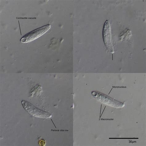 Images Gratuites Aile Micro Cercle Mikro Forme Protistes