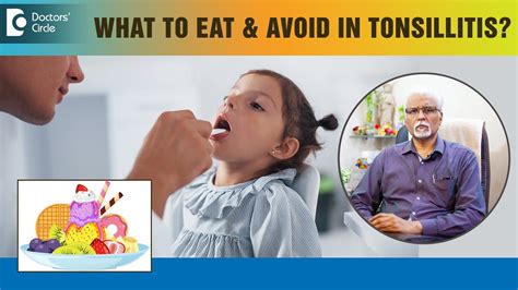 REPETITIVE TONSILLITIS Food To Eat Avoid In Severe Throat Pain Dr