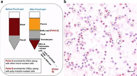 Isolation Of Pluripotent And Adult Stem Cells From Peripheral Blood