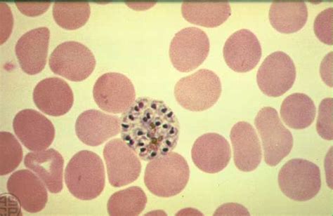 Malaria Y Plasmodium Imagenes Del Plasmodium Falciparum Y Plasmodium