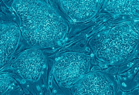 Stem Cells Summary