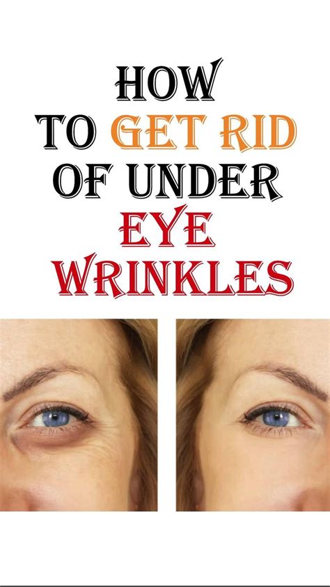 How To Prevent Wrinkles Under Your Eyes Under Eye Wrinkles Wrinkles