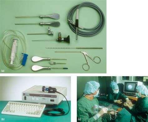 33 Temporomandibular Joint Surgery Including Arthroscopy Pocket
