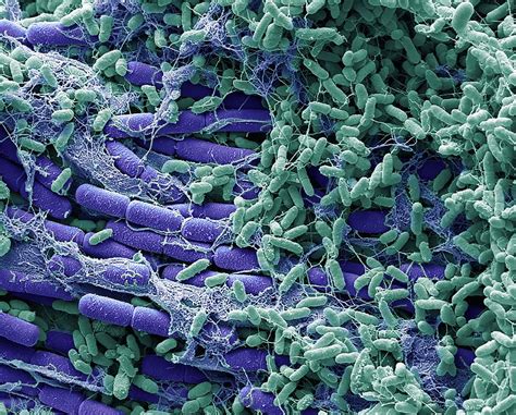 Bacteria From A House Fly Photograph By Steve Gschmeissnerscience