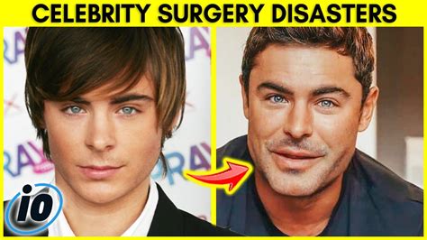 Top Celebrity Plastic Surgery Disasters Youtube
