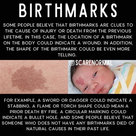 Birthmarks Spiritual Psychological Facts Interesting Birthmark Past