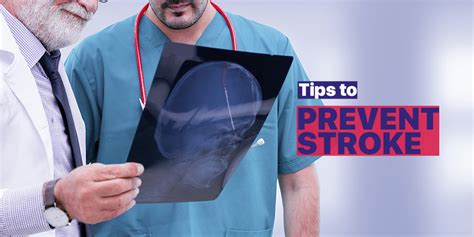 Identify Manage And Prevent A Stroke On Time To Help Lives Blog