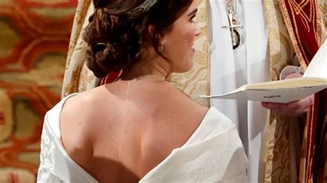 Casamento Real Por Que A Princesa Eugenie Escolheu Um Vestido Que Deixava Sua Cicatriz à Mostra