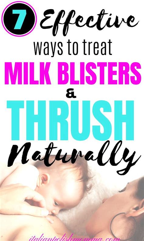 7 Effective Ways To Treat Milk Blisters And Thrush Naturally