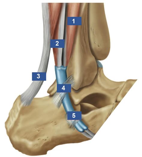 Peroneal Tendon Tears And Instability Foot Ankle Orthobullets