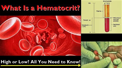 Hematocrit Normal Range Low And High Levels Causes Youtube
