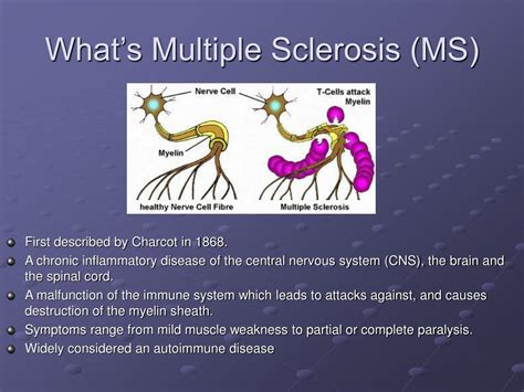 Ppt Multiple Sclerosis Powerpoint Presentation Free Download Id69674